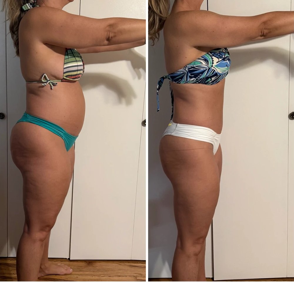 Before and after, side view