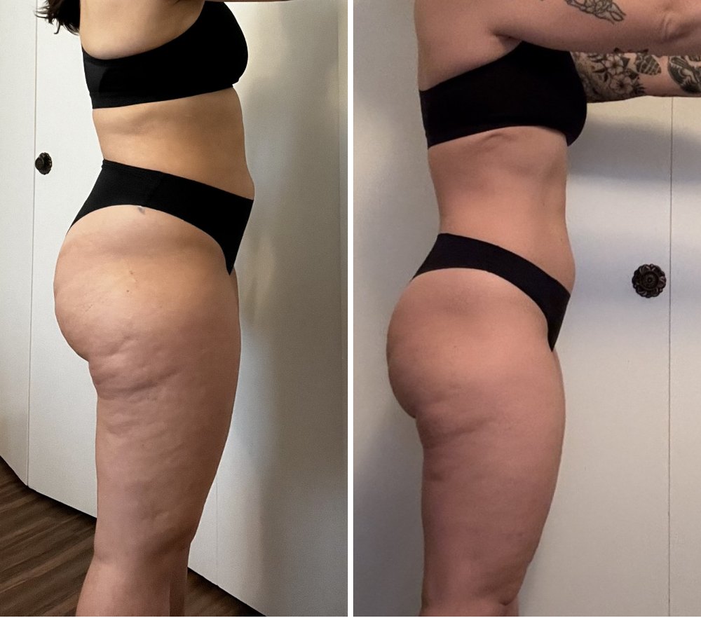 Before and after, side view