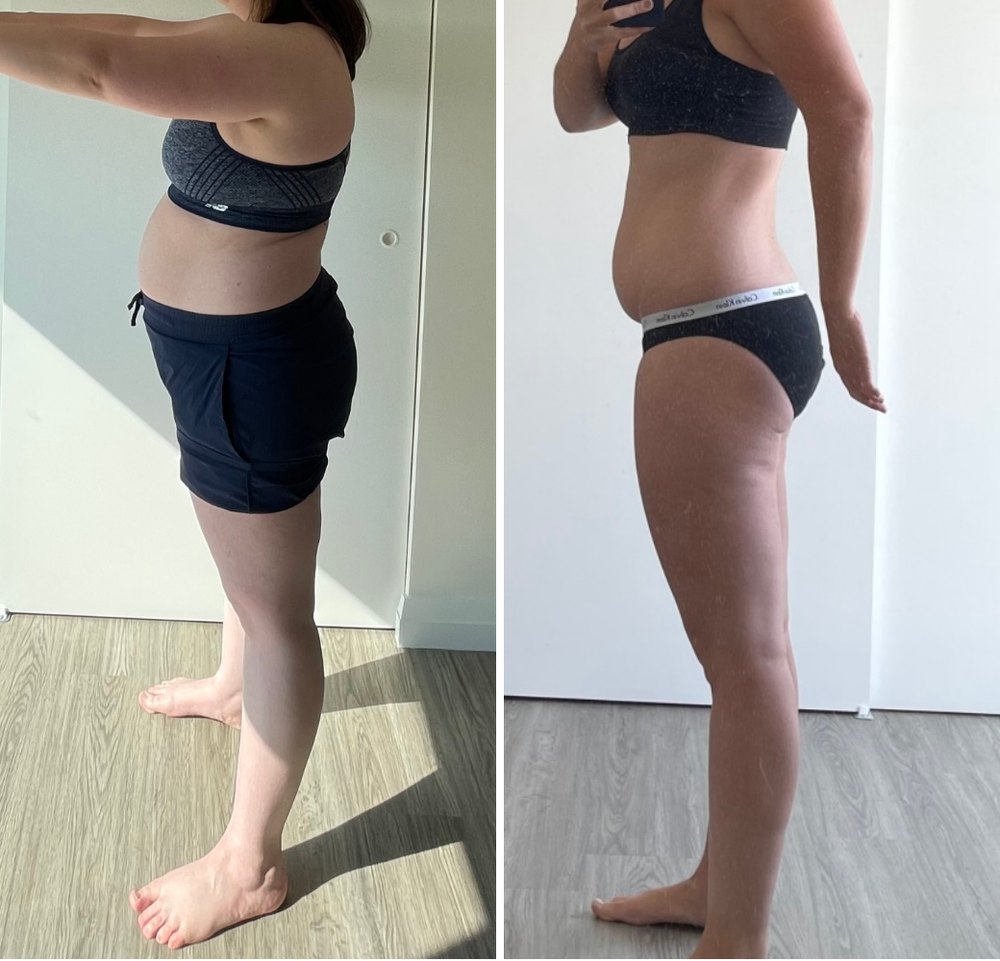 Before and after, side view