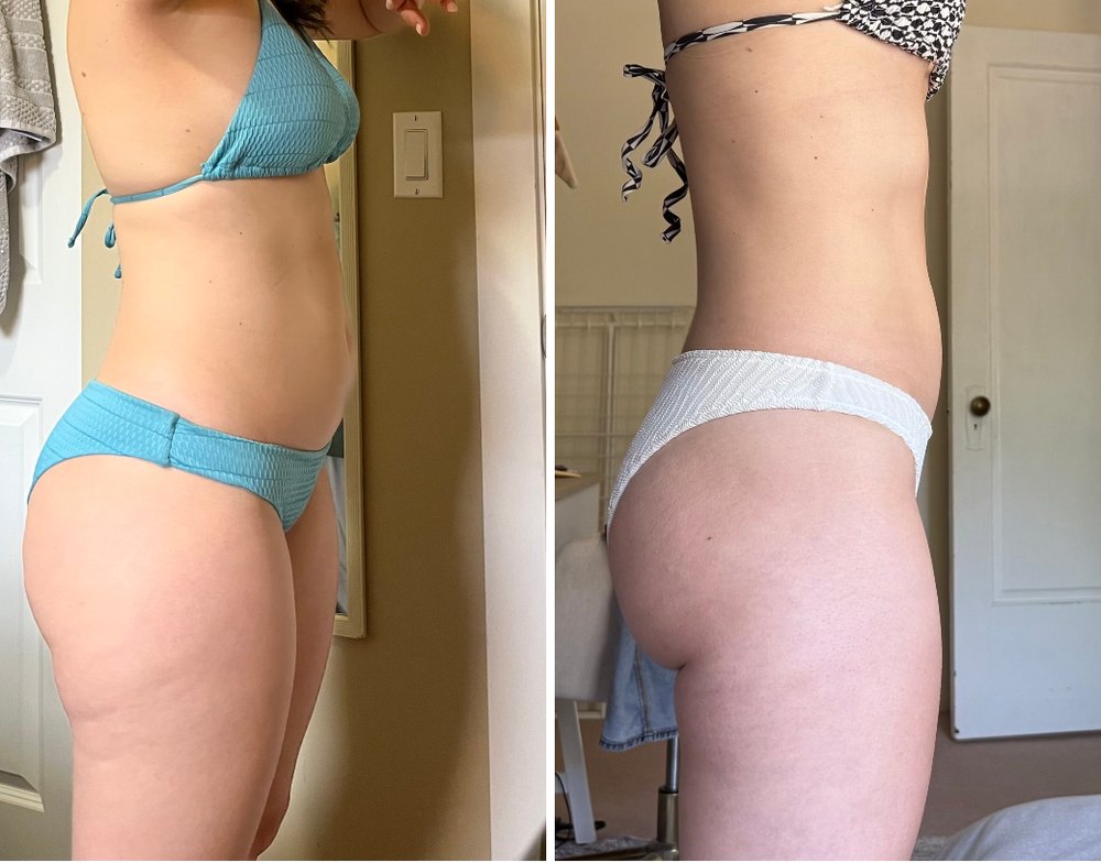 Before and after, side view